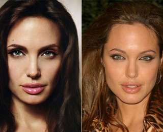 Джоли До И После Пластики Фото
