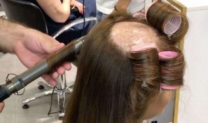 Если парикмахер пережег волосы
