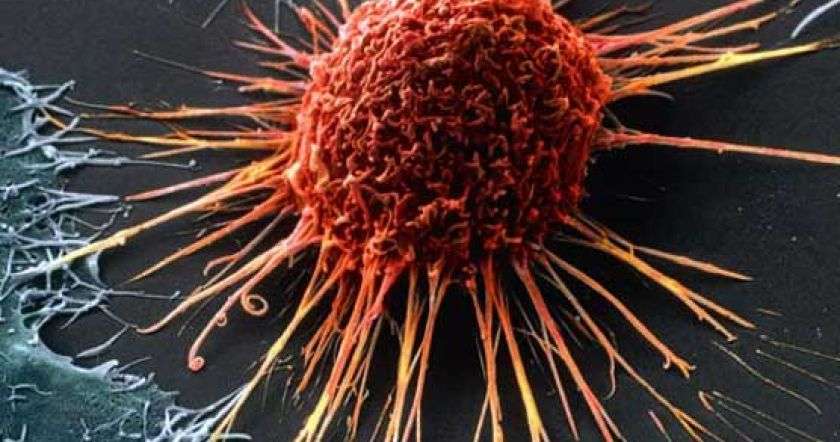 Մարդկությունը երբեք չի հաղթահարի քաղցկեղը․ գիտնականներ
